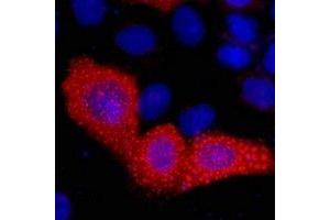 Immunofluorescent analysis of VSV-G-tag staining in 293T cells transfected with a VSV-G-tag protein. (VSV-g Tag antibody)