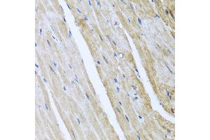 Immunohistochemistry of paraffin-embedded mouse heart using CAMK2G antibody at dilution of 1:100 (x40 lens).