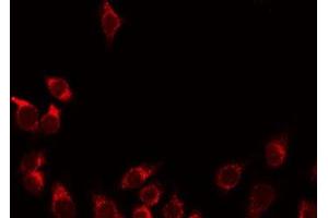 ABIN6275901 staining Hela by IF/ICC. (PLG antibody  (Internal Region))