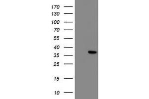 HEK293T cells were transfected with the pCMV6-ENTRY control (Left lane) or pCMV6-ENTRY NRIP3 (Right lane) cDNA for 48 hrs and lysed. (NRIP3 antibody)