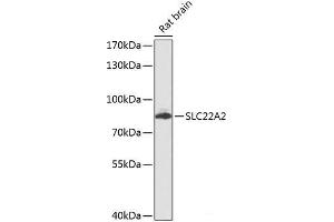 Western blot analysis of extracts of Rat brain using SLC22A2 Polyclonal Antibody at dilution of 1:1000.