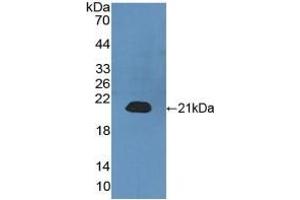 Detection of Recombinant CALML3, Human using Polyclonal Antibody to Calmodulin Like Protein 3 (CALML3) (CALML3 antibody  (AA 1-149))