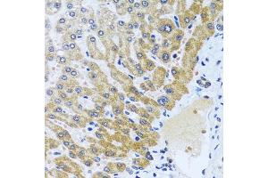Immunohistochemistry of paraffin-embedded human liver using CP antibody (ABIN6129673, ABIN6138930, ABIN6138932 and ABIN6217722) at dilution of 1:100 (40x lens). (CPA6 antibody  (AA 130-437))