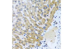 Immunohistochemistry of paraffin-embedded human liver using CP antibody (ABIN6129673, ABIN6138930, ABIN6138932 and ABIN6217722) at dilution of 1:100 (40x lens). (CPA6 antibody  (AA 130-437))
