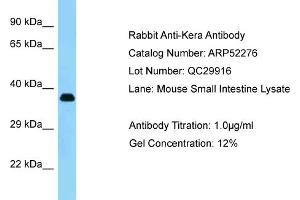 Western Blotting (WB) image for anti-Keratocan (KERA) (C-Term) antibody (ABIN2784856) (KERA antibody  (C-Term))