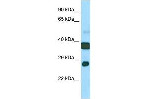 Host:  Rabbit  Target Name:  Atp5c1  Sample Type:  Mouse Stomach lysates  Antibody Dilution:  1. (ATP5C1 antibody  (N-Term))
