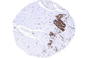 Colon descendes muscular wall Strong PGP9. (Recombinant UCHL1 antibody)