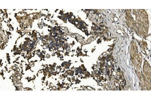 IHC analysis of RGS6 using anti-RGS6 antibody (ABIN7602326). (RGS6 antibody  (AA 7-357))