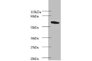 Western blot All lanes: Proteasome subunit beta type-4 Antibody at 2 μg/mL + EC109 whole cell lysate Secondary Goat polyclonal to rabbit IgG at 1/15000 dilution Predicted band size: 30 kDa Observed band size: 75 kDa (PSMB4 antibody  (AA 46-264))