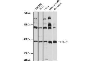 Western blot analysis of extracts of various cell lines, using PNM antibody (4558) at 1:3000 dilution. (PNMA1 antibody  (AA 1-353))