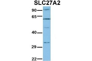 WB Suggested Anti-SLC27A2 Antibody Titration:  1 ug/ml  Positive Control:  Jurkat lysate (SLC27A2 antibody  (N-Term))
