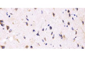 Immunohistochemistry of paraffin-embedded Rat brain using PPP2R4 Polyclonal Antibody at dilution of 1:200 (40x lens). (PPP2R4 antibody)