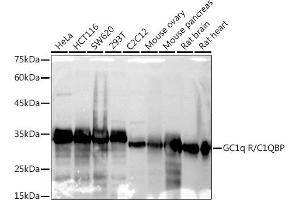 Western blot analysis of extracts of various cell lines, using GC1q R/C1QBP antibody (ABIN7266473) at 1:1000 dilution. (C1QBP antibody)