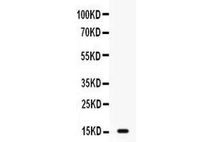 Western blot analysis of GIP expression in MCF-7 whole cell lysates ( Lane 1). (GIP antibody  (AA 52-93))