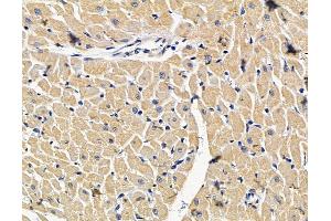 ABIN7096619 and ABIN7100683 at 1/100 staining rat heart tissue by IHC-P.