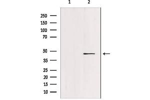 Western blot analysis of extracts from c476, using FOXN2 Antibody. (FOXN2 antibody  (C-Term))