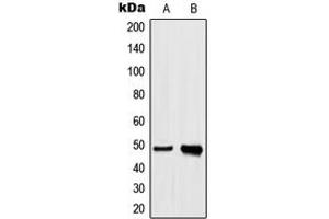 Western blot analysis of hnRNP H expression in A549 (A), HeLa (B) whole cell lysates. (HNRNPH1 antibody  (Center))