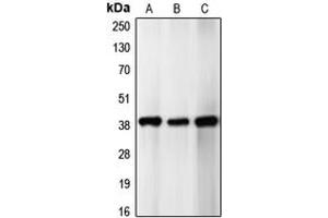 Western blot analysis of p39 expression in SHSY5Y (A), HeLa (B), U87MG (C) whole cell lysates. (p39 (Center) antibody)