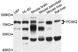 Western blot analysis of extracts of various cell lines, using PCSK2 antibody (ABIN5996172) at 1/1000 dilution. (PCSK2 antibody)