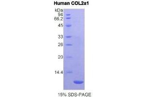 SDS-PAGE (SDS) image for Collagen, Type II, alpha 1 (COL2A1) (AA 1386-1467) protein (His tag) (ABIN2120851) (COL2A1 Protein (AA 1386-1467) (His tag))