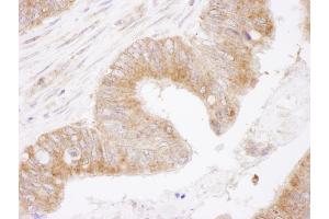 Immunohistochemistry (IHC) image for anti-B-Cell CLL/lymphoma 2 (BCL2) (AA 50-100) antibody (ABIN7454495) (Bcl-2 antibody  (AA 50-100))