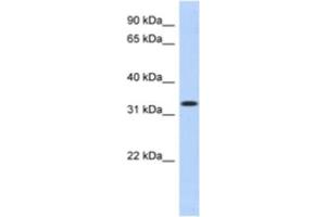 Western Blotting (WB) image for anti-metallophosphoesterase Domain Containing 2 (MPPED2) antibody (ABIN2463910) (MPPED2 antibody)