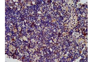 IHC image of ABIN7168933 diluted at 1:400 and staining in paraffin-embedded human tonsil tissue performed on a Leica BondTM system.