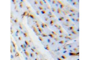 Used in DAB staining on fromalin fixed paraffin-embedded Heart tissue (LGALS1/Galectin 1 antibody  (AA 1-135))