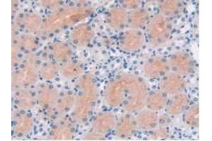 IHC-P analysis of Mouse Kidney Tissue, with DAB staining. (PARP1 antibody  (AA 661-881))