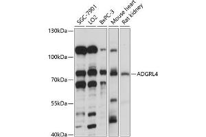Western blot analysis of extracts of various cell lines, using  antibody (ABIN7266908) at 1:1000 dilution. (ELTD1 antibody  (AA 110-406))