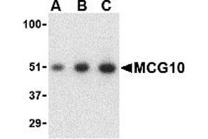 Western Blotting (WB) image for anti-Poly(rC) Binding Protein 4 (PCBP4) (C-Term) antibody (ABIN1030510)