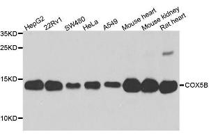 Western blot analysis of extracts of various cell lines, using COX5B antibody. (COX5B antibody  (AA 32-129))
