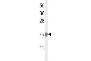 Western blot analysis of p21 antibody and HeLa lysate (p21 antibody  (AA 105-140))
