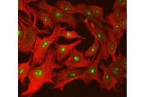 IF analysis of SPT5/SUPT5H using anti-SPT5/SUPT5H antibody (ABIN7601985) and anti-Tubulin beta antibody (ABIN7602744). (SUPT5H antibody  (AA 533-1087))
