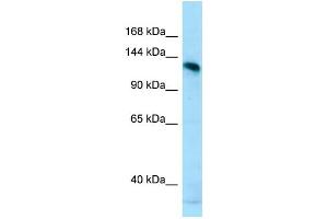 WB Suggested Anti-AMPD2 Antibody Titration: 1. (AMPD2 antibody  (N-Term))