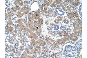 ST3GAL5 antibody was used for immunohistochemistry at a concentration of 4-8 ug/ml. (ST3GAL5 antibody  (N-Term))
