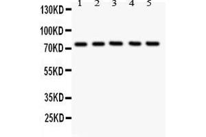 Anti- 12 Lipoxygenase antibody, Western blottingAll lanes: Anti ANOX12  at 0. (ALOX12 antibody  (C-Term))