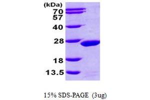 SDS-PAGE (SDS) image for Magnesium-Dependent Phosphatase 1 (MDP1) (AA 1-176) protein (His tag) (ABIN667293) (MDP1 Protein (AA 1-176) (His tag))