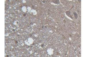DAB staining on IHC-P; Samples: Rat Spinal cord Tissue (GLRa2 antibody  (AA 28-253))