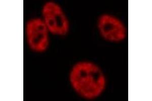 ABIN6276724 staining HepG2? (CDK9 antibody  (Internal Region))