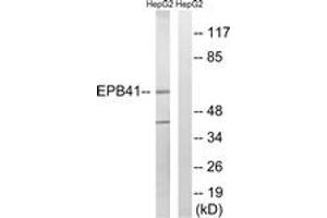 Image no. 1 for anti-Erythrocyte Membrane Protein Band 4.1 (Elliptocytosis 1, RH-Linked) (EPB41) (AA 626-675) antibody (ABIN2889146)