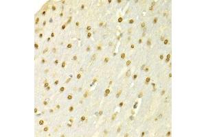 Immunohistochemistry of paraffin-embedded rat brain using SFN Antibody. (14-3-3 sigma/SFN antibody  (AA 1-248))