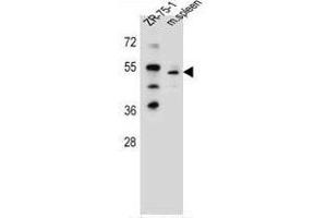 TBX6 Antibody (Center) western blot analysis in ZR-75-1 cell line and mouse spleen tissue lysates (35µg/lane). (T-Box 6 antibody  (Middle Region))