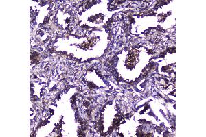IHC analysis of TLR1 using anti-TLR1 antibody . (TLR1 antibody  (AA 350-404))