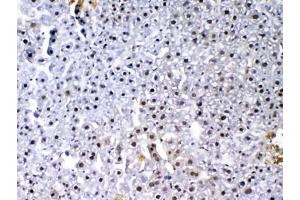 IHC testing of FFPE mouse liver tissue with VEGF Receptor 3 antibody at 1ug/ml.