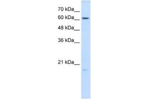 Western Blotting (WB) image for anti-Glutathione Peroxidase 3 (Plasma) (GPX3) antibody (ABIN2462422) (GPX3 antibody)