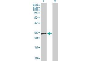 Western Blot analysis of VEGFB expression in transfected 293T cell line by VEGFB MaxPab polyclonal antibody. (VEGFB antibody  (AA 1-207))
