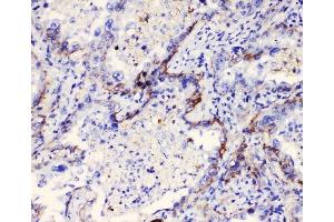 IHC analysis of Integrin alpha 3 using anti-Integrin alpha 3 antibody (ABIN6719410). (ITGA3 antibody)