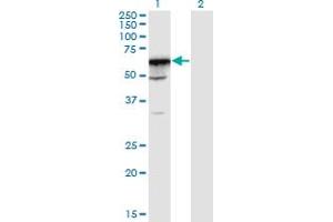 Western Blot analysis of PRPF31 expression in transfected 293T cell line by PRPF31 monoclonal antibody (M02), clone 8E1.