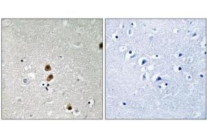 Immunohistochemistry analysis of paraffin-embedded human brain tissue, using CtBP1 (Phospho-Ser422) antibody. (CTBP1 antibody  (pSer422))